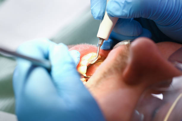 Best Emergency Root Canal Treatment in Steep Falls, ME