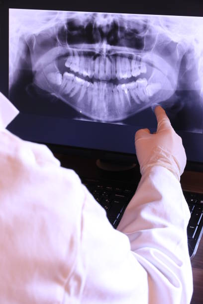 Best Emergency Tooth Extraction in Steep Falls, ME