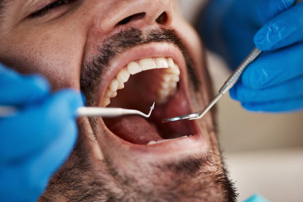 Best Emergency Gum Treatment in Steep Falls, ME